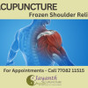 Discover 7 key benefits of acupuncture for frozen shoulder pain relief. Learn how it reduces pain, improves mobility, and promotes holistic healing.