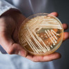 European health authorities are sounding the alarm over the rapid spread of the Multidrug-Resistant Candida Auris, which is increasingly being detected in hospitals across the continent. Read for more information