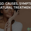 Explore natural vitiligo treatments with ProVitale Health’s holistic approach to managing symptoms and improving wellness