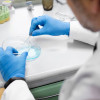 Surgical Sperm Retrieval is a specialized fertility treatment for men with no sperm in their semen, enabling sperm collection directly from the testes. It offers hope for biological parenthood through assisted reproductive techniques like IVF or ICSI.