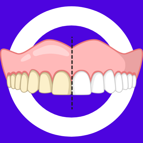 Achieve a brighter, whiter smile with White and Bright, Brisbane’s trusted and most-revi...