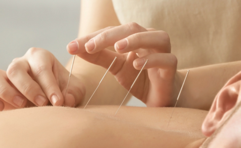 Acupuncture Treatment for Elderly Care a natural healing solution helps relieve pain, impr...