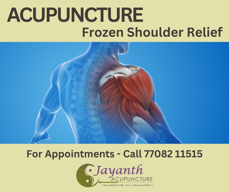 Discover 7 key benefits of acupuncture for frozen shoulder pain relief. Learn how it reduc...