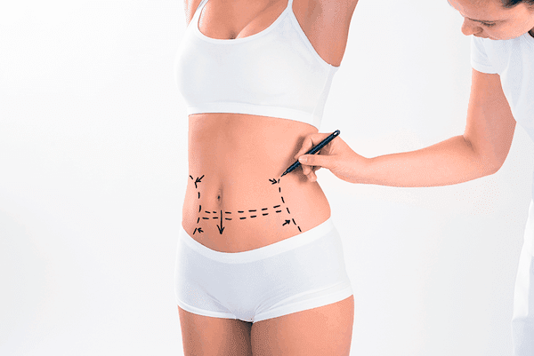 Experts manage liposuction complications through early detection, precise treatment, and c...