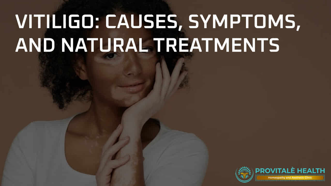 Explore natural vitiligo treatments with ProVitale Health’s holistic approach to managin...