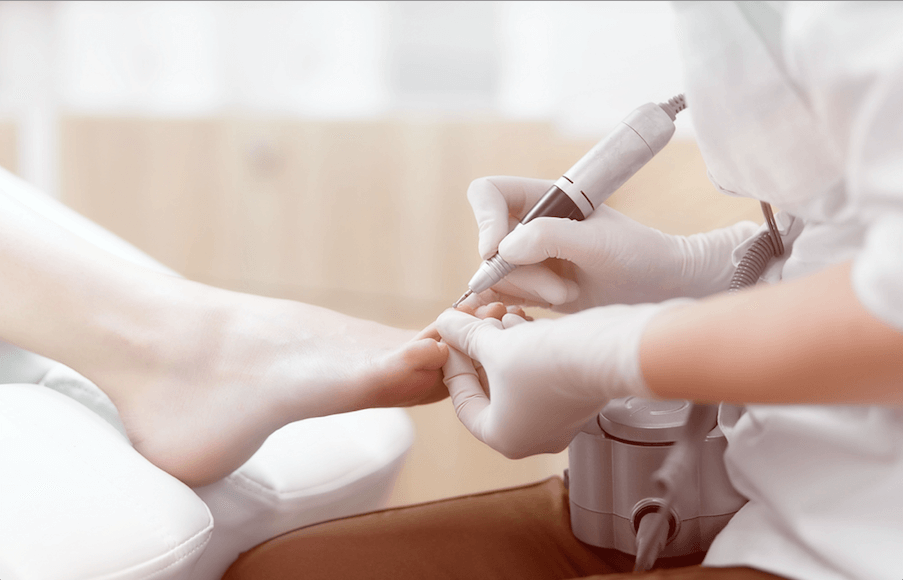 Learn about Partial vs Full Nail Removal Townsville at Ian's Podiatry. Discover the best t...