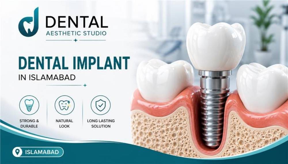 Learn how long dental implants last, what affects their lifespan, and how proper care can ...