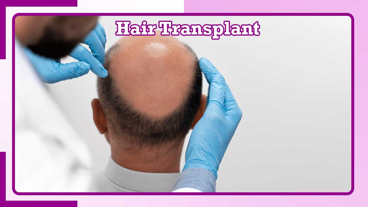 Looking for the best hair transplant in Nepal? Book a consultation at Lucent Skin and Hair...