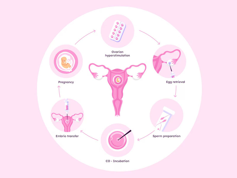 SCI IVF Hospital is the best icsi treatment centre in Delhi, providing advanced, personali...