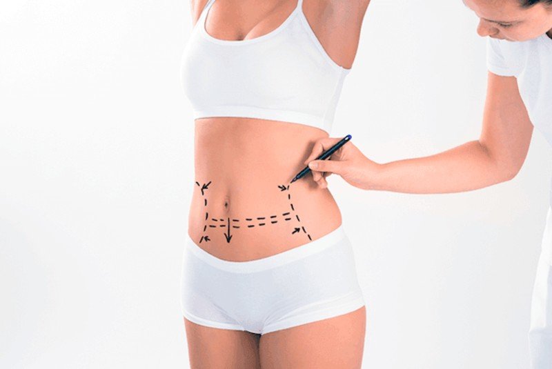 The best treatments for lipo lumps and bumps focus on smoothing uneven tissue and improvin...